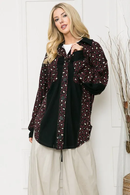 OAKLEY OVERSIZED ELBOW PATCH SHACKET